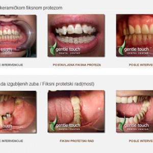 Gentle_touch-dental_centar-374