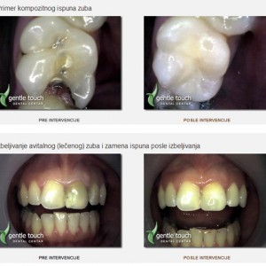 Gentle_touch-dental_centar-469
