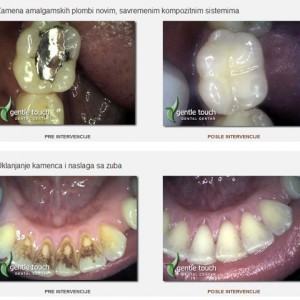 Gentle_touch-dental_centar-559