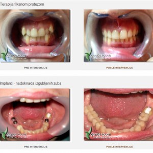 Gentle_touch-dental_centar-75