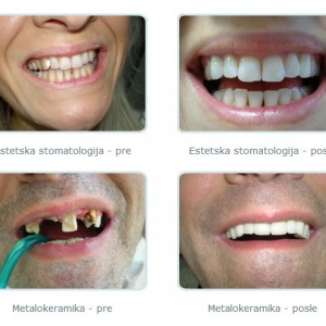 Stomatoloska_ordinacija-Dr_Biserka_Saranovic-Bankovic-120 Stomatoloska_ordinacija-Dr_Biserka_Saranovic-Bankovic-120