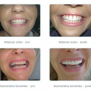 Stomatoloska_ordinacija-Dr_Biserka_Saranovic-Bankovic-261 Stomatoloska_ordinacija-Dr_Biserka_Saranovic-Bankovic-261