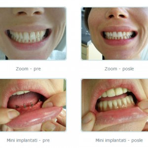 Stomatoloska_ordinacija-Dr_Biserka_Saranovic-Bankovic-47 Stomatoloska_ordinacija-Dr_Biserka_Saranovic-Bankovic-47