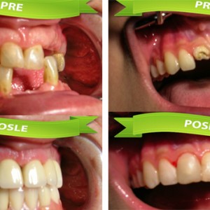 Stomatoloska_ordinacija_Caninus-434 Stomatoloska_ordinacija_Caninus-434