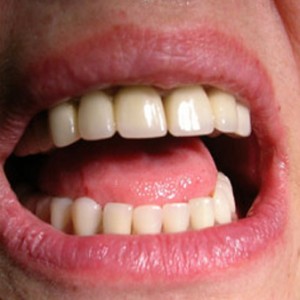 Stomatoloska_ordinacija_Caninus-579 Stomatoloska_ordinacija_Caninus-579