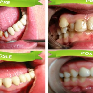 Stomatoloska_ordinacija_Caninus-849 Stomatoloska_ordinacija_Caninus-849