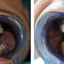 Stomatoloska_ordinacija_Minja-312