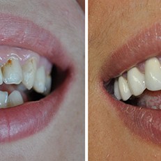 Stomatoloska_ordinacija_Minja-698