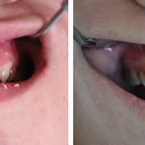 Stomatoloska_ordinacija_Minja-881